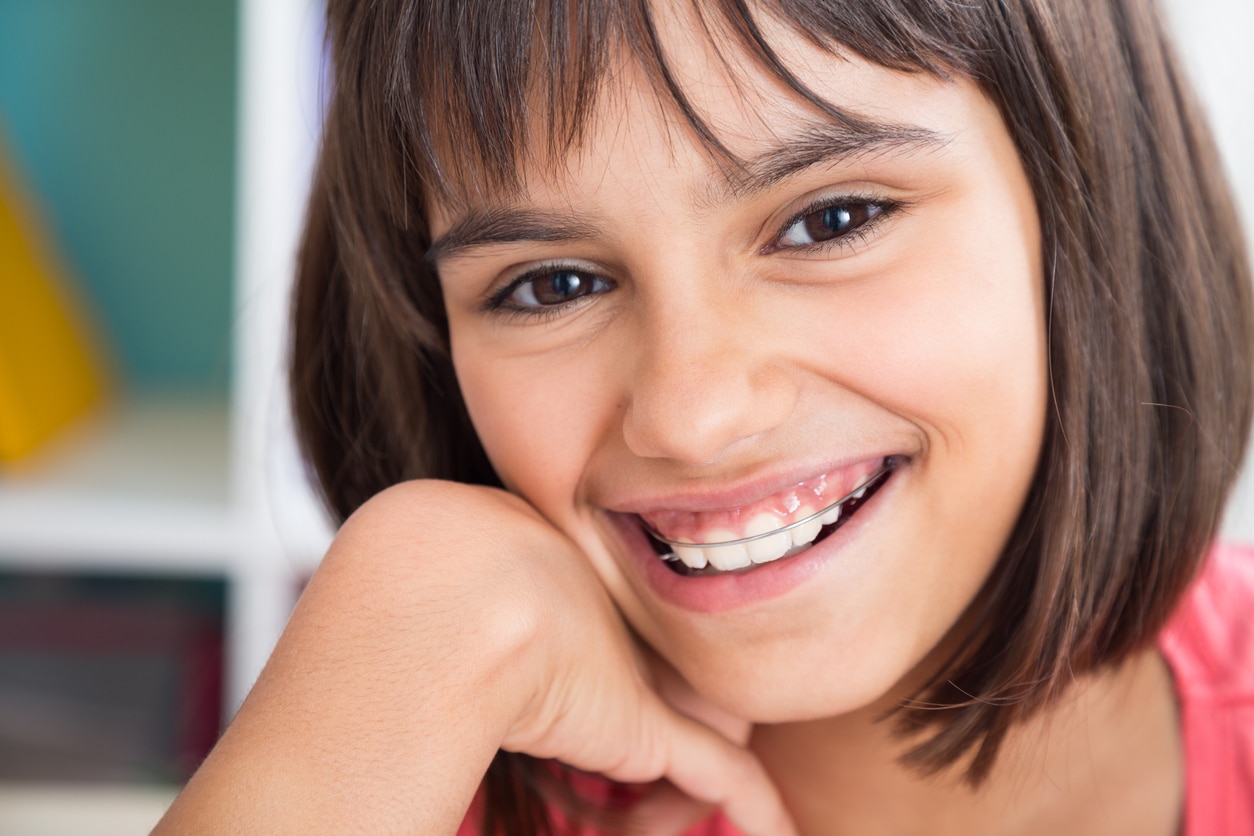 Smiling young girl with a metal retainer after undergoing early orthodontic treatment