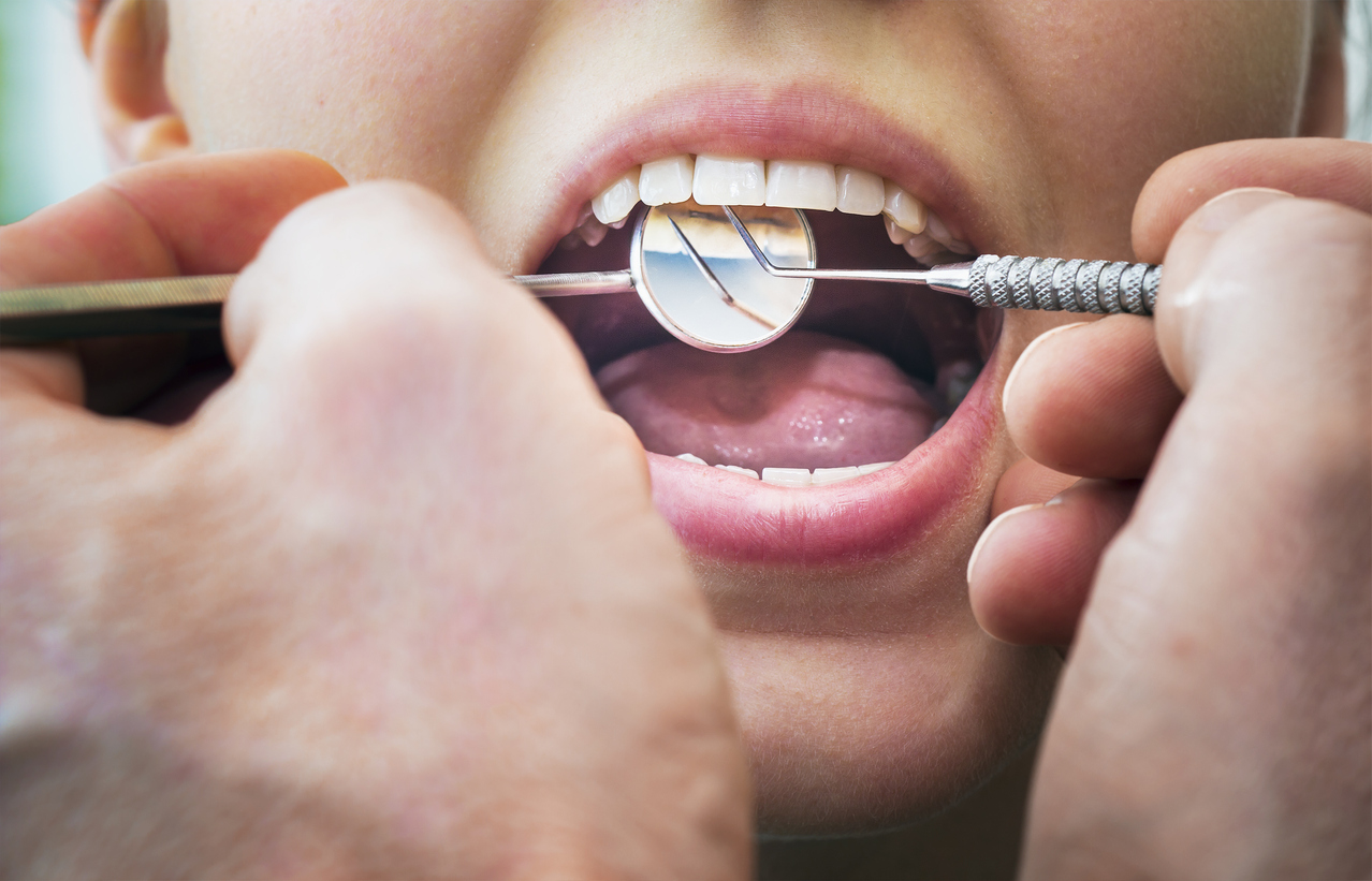 Orthodontist inspecting the permanent retainer of a patient
